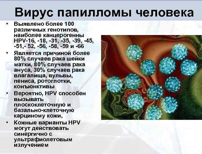 ВПЧ